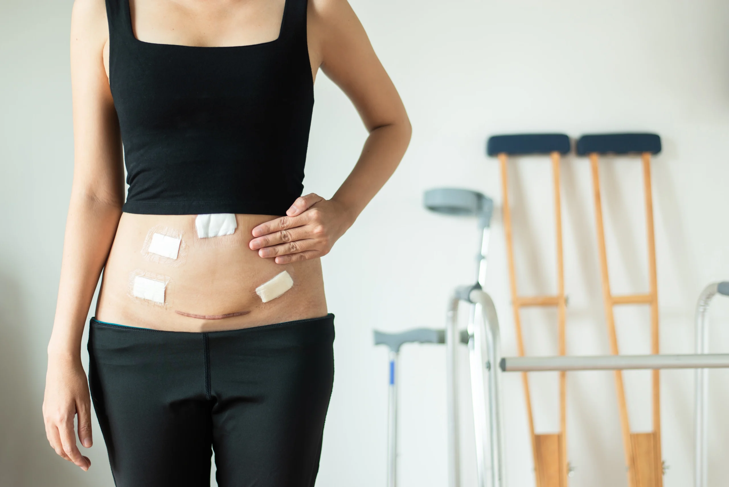 Is Laparoscopic Surgery Worth the Cost?
